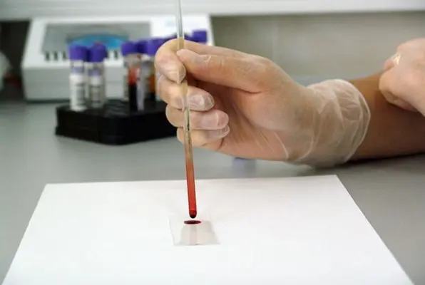 Tödlicher Virus (RuhrEscape) Escape Room