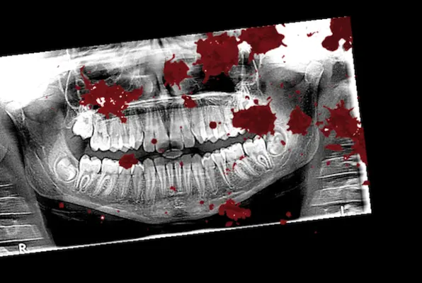 The Dentist (No Escape London) Escape Room