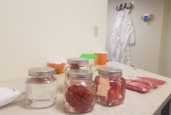 Dr. Millerson's Jumbo Seeds (Exhilarating Escapes) Escape Room